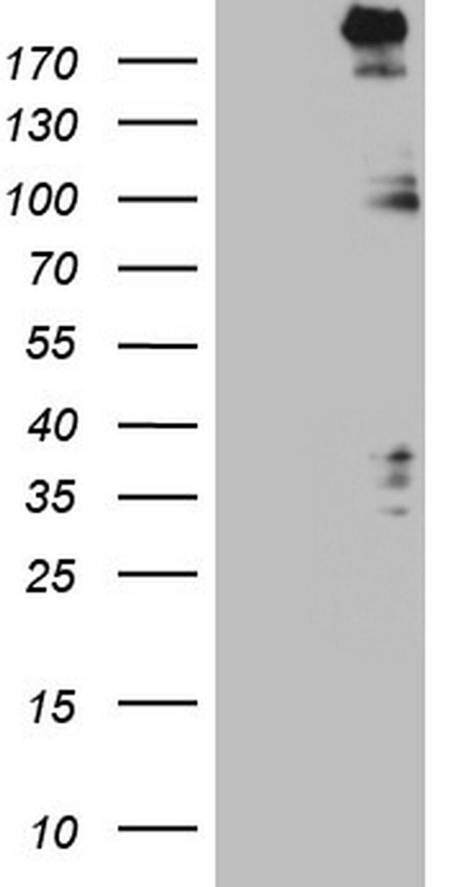 SETD1A Antibody in Western Blot (WB)