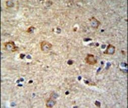 SETD6 Antibody in Immunohistochemistry (IHC)