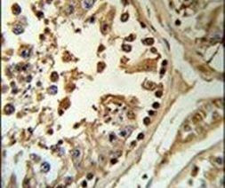 SETD8 Antibody in Immunohistochemistry (IHC)