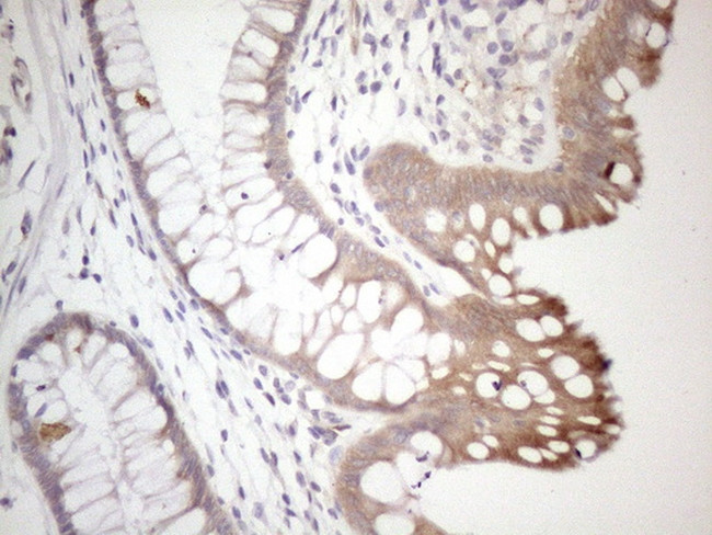 SETD8 Antibody in Immunohistochemistry (Paraffin) (IHC (P))