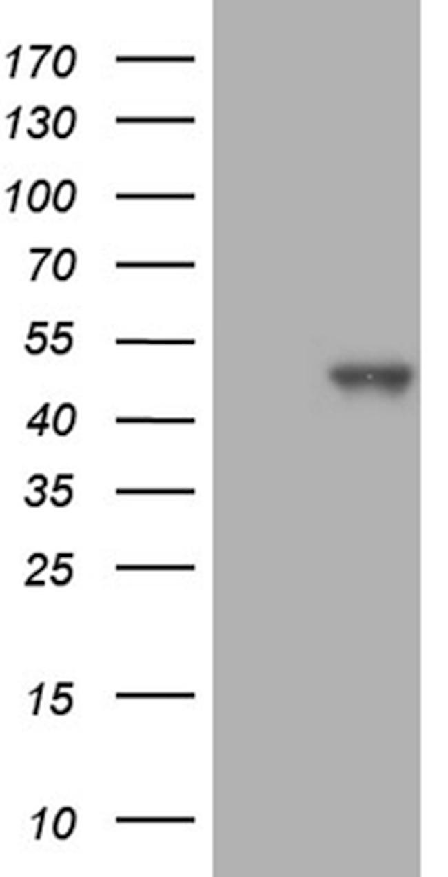 SETD8 Antibody in Western Blot (WB)