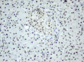 SF3A1 Antibody in Immunohistochemistry (Paraffin) (IHC (P))