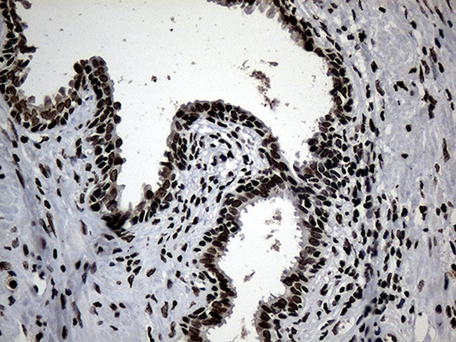 SF3B14 Antibody in Immunohistochemistry (Paraffin) (IHC (P))