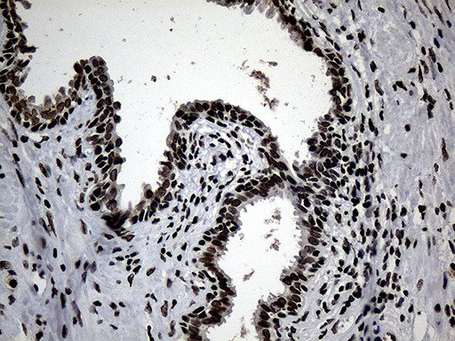 SF3B14 Antibody in Immunohistochemistry (Paraffin) (IHC (P))