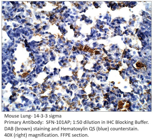 14-3-3 sigma Antibody in Immunohistochemistry (IHC)