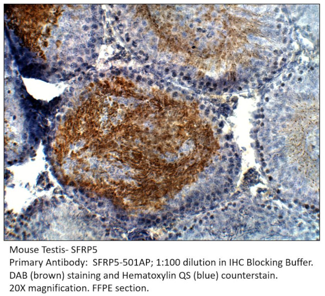 SFRP5 Antibody in Immunohistochemistry (IHC)
