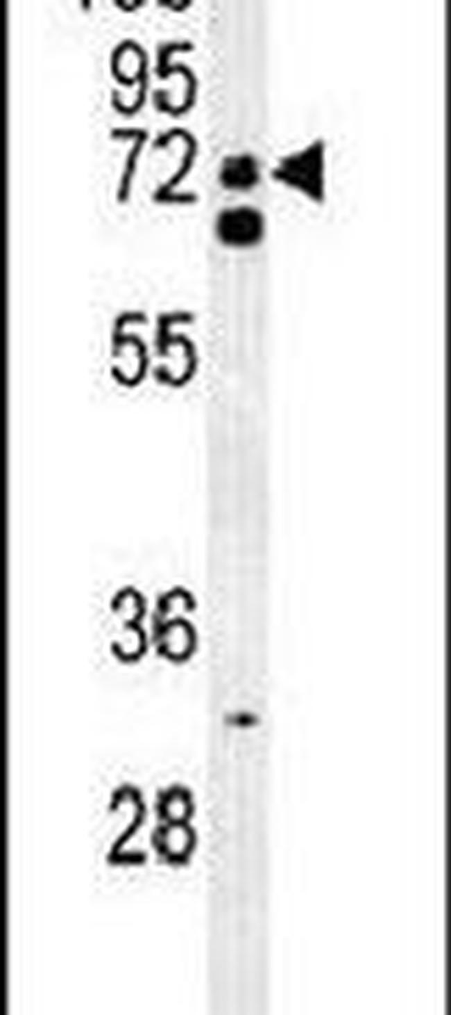 CLASRP Antibody in Western Blot (WB)