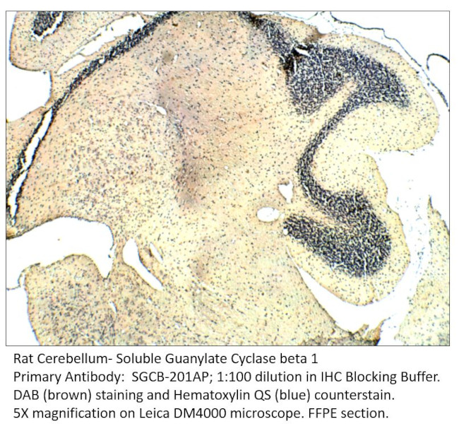 Soluble Guanylyl Cyclase beta 1 Antibody in Immunohistochemistry (IHC)