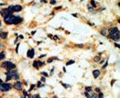 SGK2 Antibody in Immunohistochemistry (IHC)