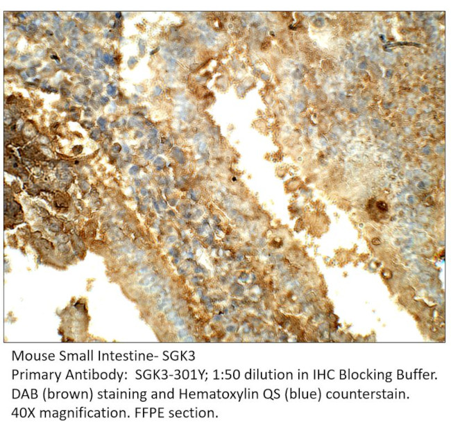 SGK3 Antibody in Immunohistochemistry (IHC)