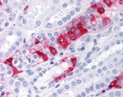 SGK3 Antibody in Immunohistochemistry (Paraffin) (IHC (P))