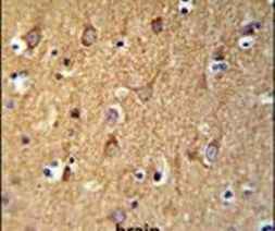 SGMS2 Antibody in Immunohistochemistry (IHC)