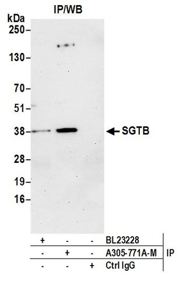 SGTB Antibody in Immunoprecipitation (IP)