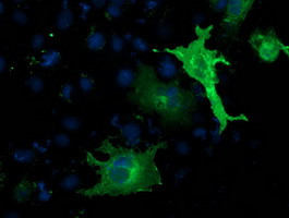SH2B3 Antibody in Immunocytochemistry (ICC/IF)