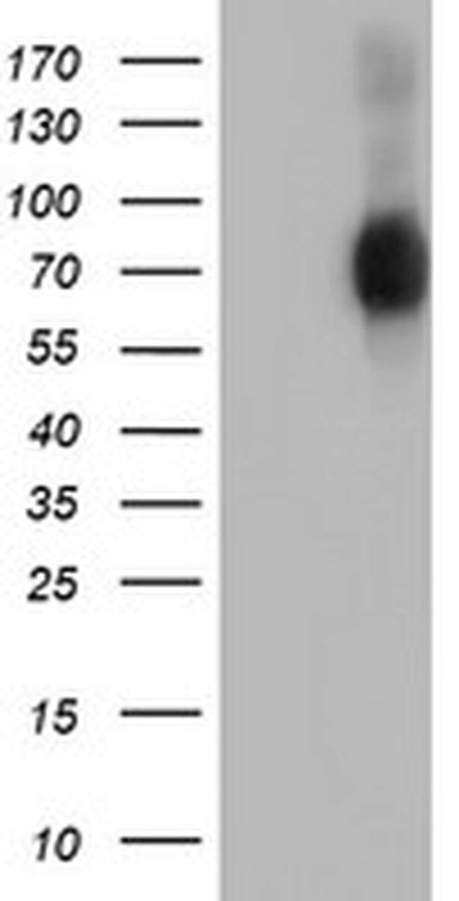 SH2B3 Antibody in Western Blot (WB)