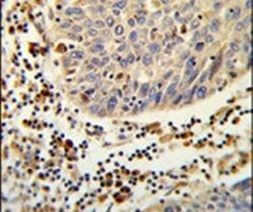 SH2D1B Antibody in Immunohistochemistry (IHC)