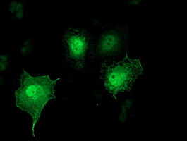 SH2D2A Antibody in Immunocytochemistry (ICC/IF)
