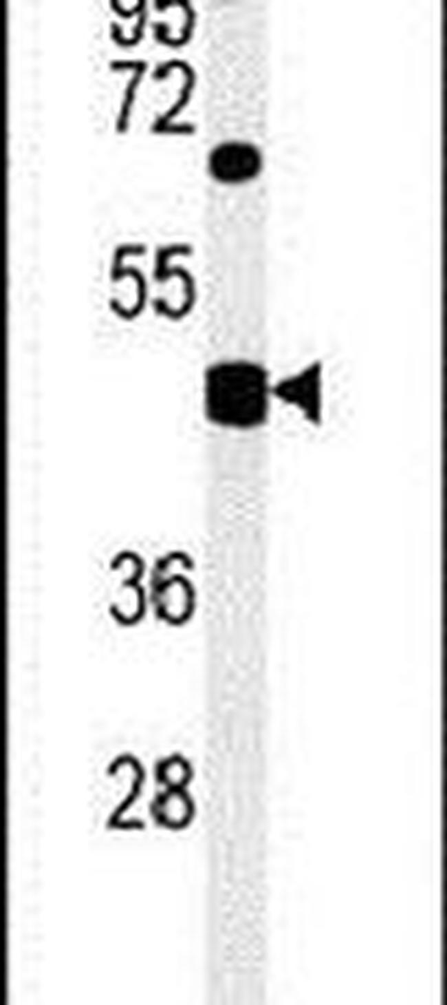 SH2D2A Antibody in Western Blot (WB)