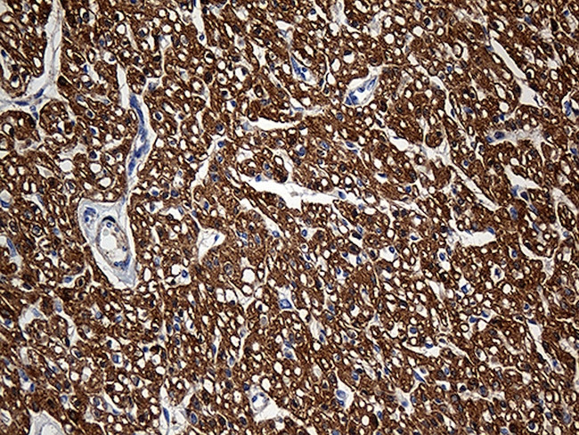 SH3BGR Antibody in Immunohistochemistry (Paraffin) (IHC (P))