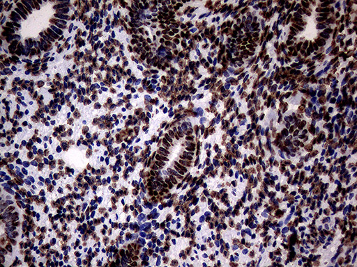 SH3BGRL Antibody in Immunohistochemistry (Paraffin) (IHC (P))