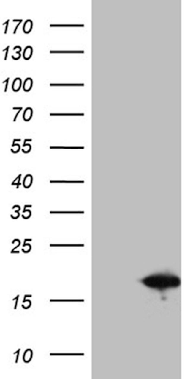 SH3BGRL Antibody in Western Blot (WB)