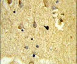 SH3BGRL3 Antibody in Immunohistochemistry (IHC)