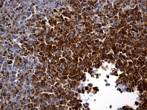 SH3BP1 Antibody in Immunohistochemistry (Paraffin) (IHC (P))
