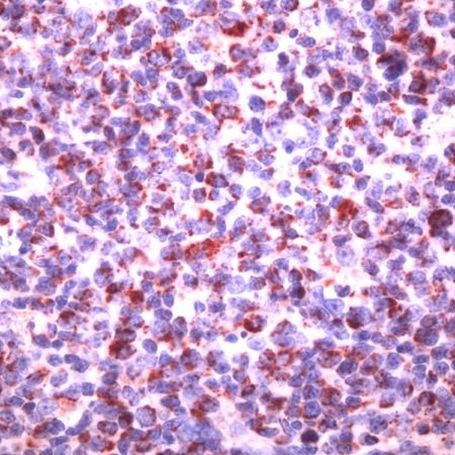 SHIP1 Antibody in Immunohistochemistry (IHC)