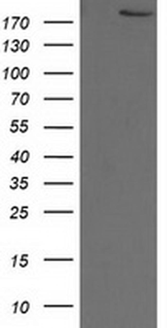 SHPRH Antibody in Western Blot (WB)