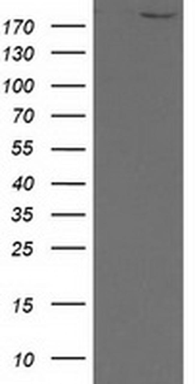 SHPRH Antibody in Western Blot (WB)
