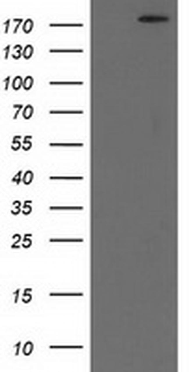 SHPRH Antibody in Western Blot (WB)