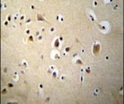SIAH2 Antibody in Immunohistochemistry (IHC)