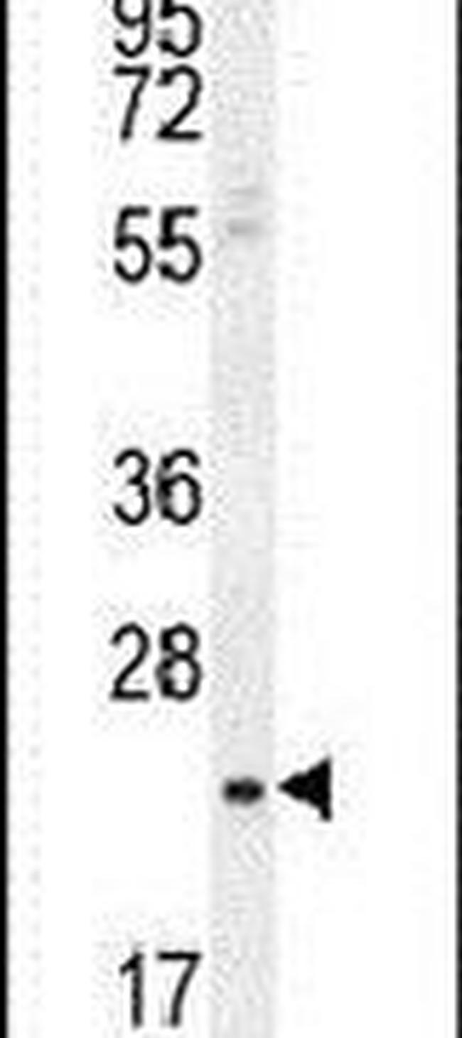 SIAH3 Antibody in Western Blot (WB)