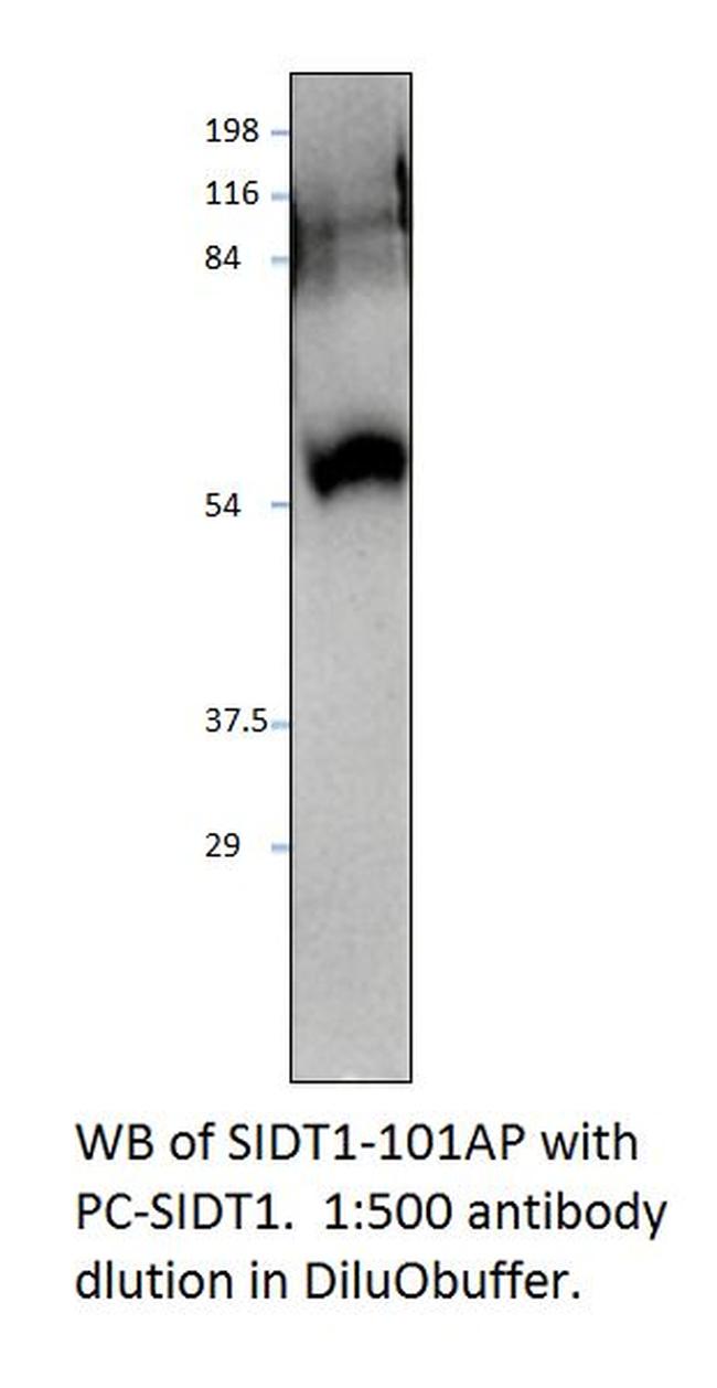 SIDT1 Antibody in Western Blot (WB)