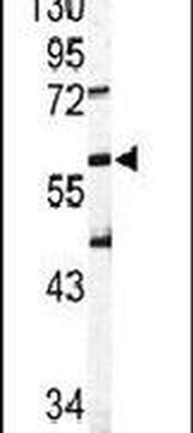 SIGLEC6 Antibody in Western Blot (WB)