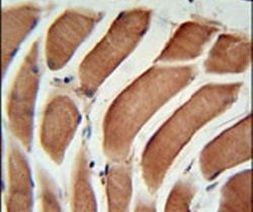 SIKE Antibody in Immunohistochemistry (IHC)