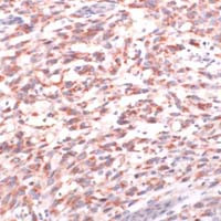 PMEL Antibody in Immunohistochemistry (IHC)