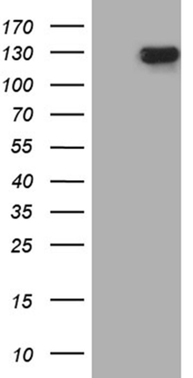 SIRT1 Antibody in Western Blot (WB)