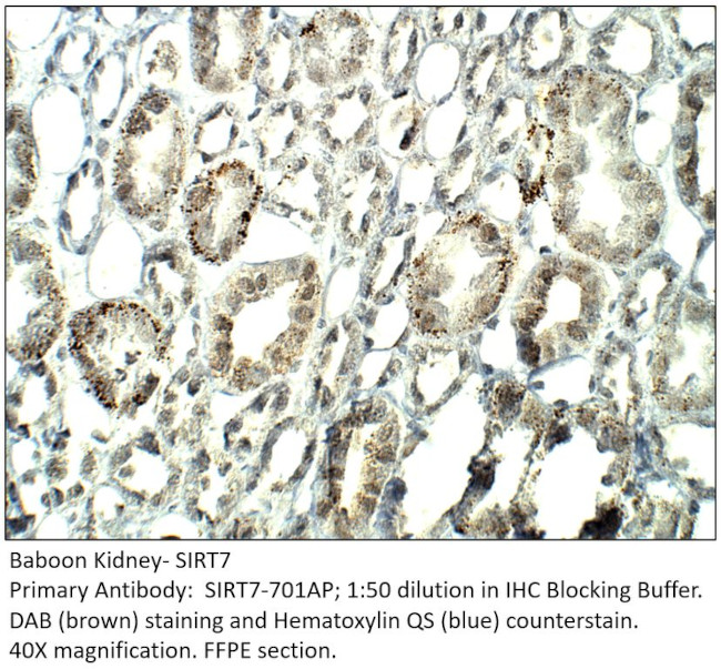 SIRT7 Antibody in Immunohistochemistry (IHC)