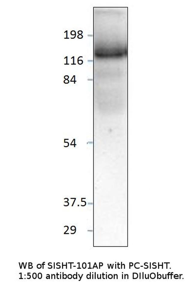 Slingshot homolog 1 Antibody in Western Blot (WB)