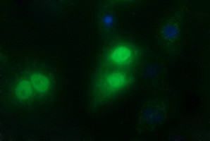 SIVA1 Antibody in Immunocytochemistry (ICC/IF)