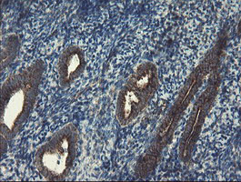 SKIL Antibody in Immunohistochemistry (Paraffin) (IHC (P))