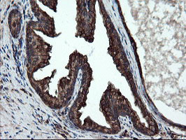 SKIL Antibody in Immunohistochemistry (Paraffin) (IHC (P))