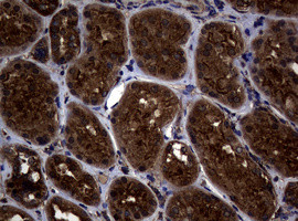 SKIL Antibody in Immunohistochemistry (Paraffin) (IHC (P))