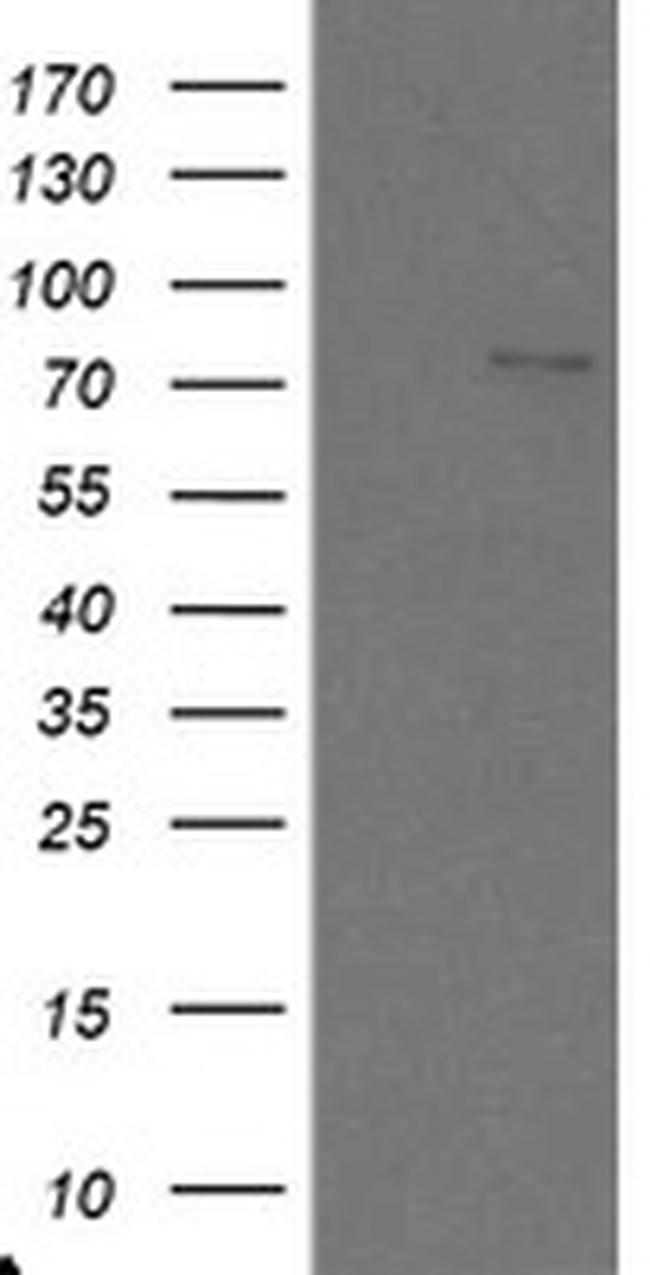 SKIL Antibody in Western Blot (WB)