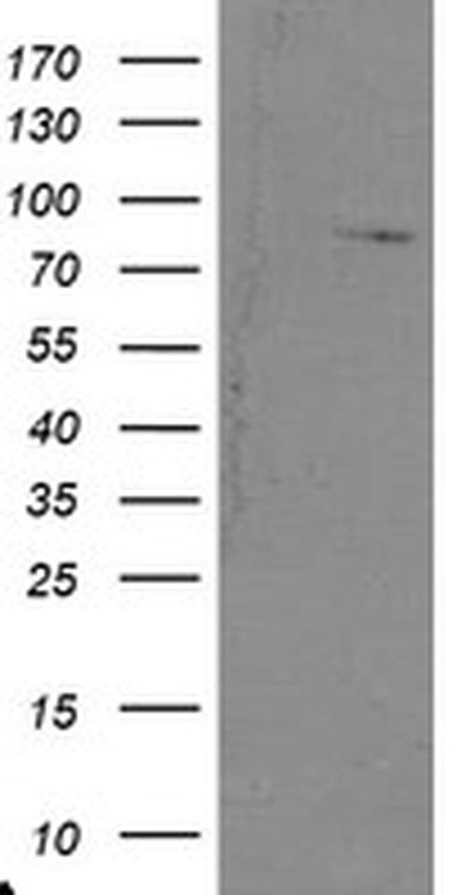SKIL Antibody in Western Blot (WB)
