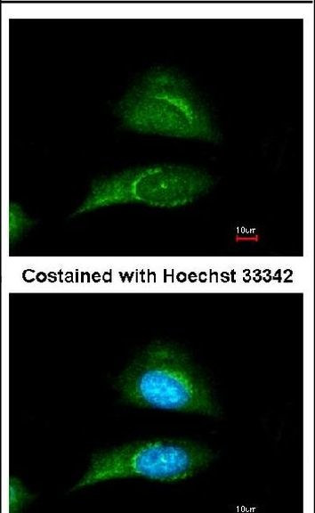 SKIP Antibody in Immunocytochemistry (ICC/IF)