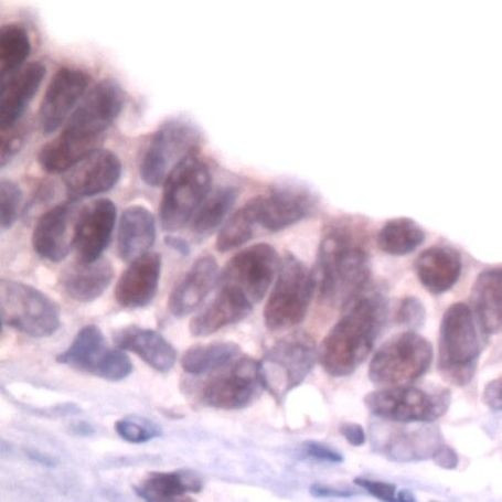 SKP1 Antibody in Immunohistochemistry (IHC)