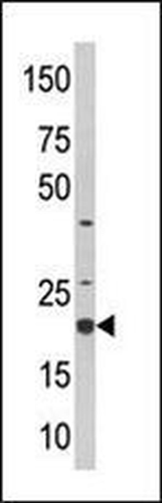 SKP1 Antibody in Western Blot (WB)