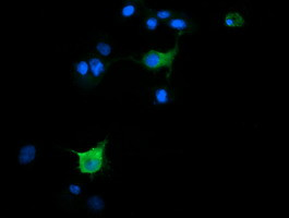 SLA2 Antibody in Immunocytochemistry (ICC/IF)